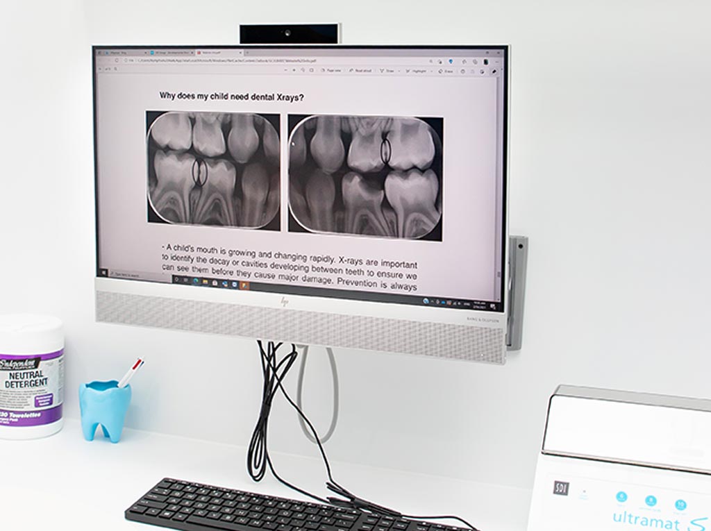 Educational screen explaining why children need dental X-rays at NLPD